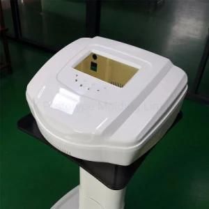 Customized Rapid Prototyping Plastic Housing for Beauty Equipment Shell